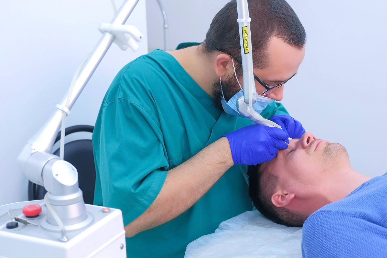 le greffe de cheveux au laser est-elle efficace