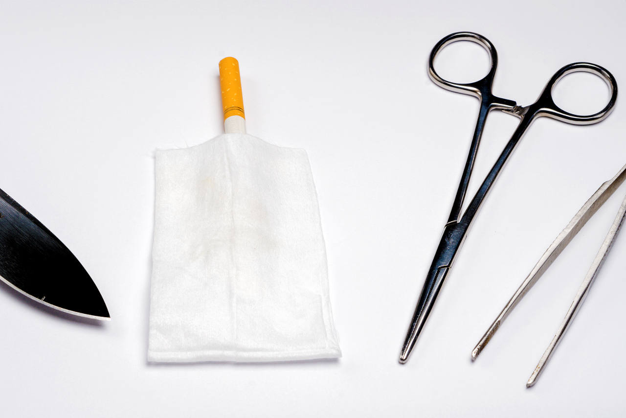 les risques liès au tabagisme sont nombreux notamment lors d'une chirurgie capillaire