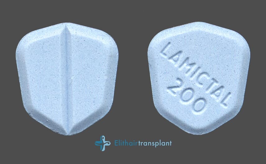 lamotrigine et perte de cheveux