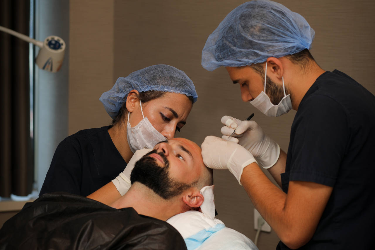 une clinique experimente saura toujours trouver la zone donneuse ideale pour votre greffe de cheveux