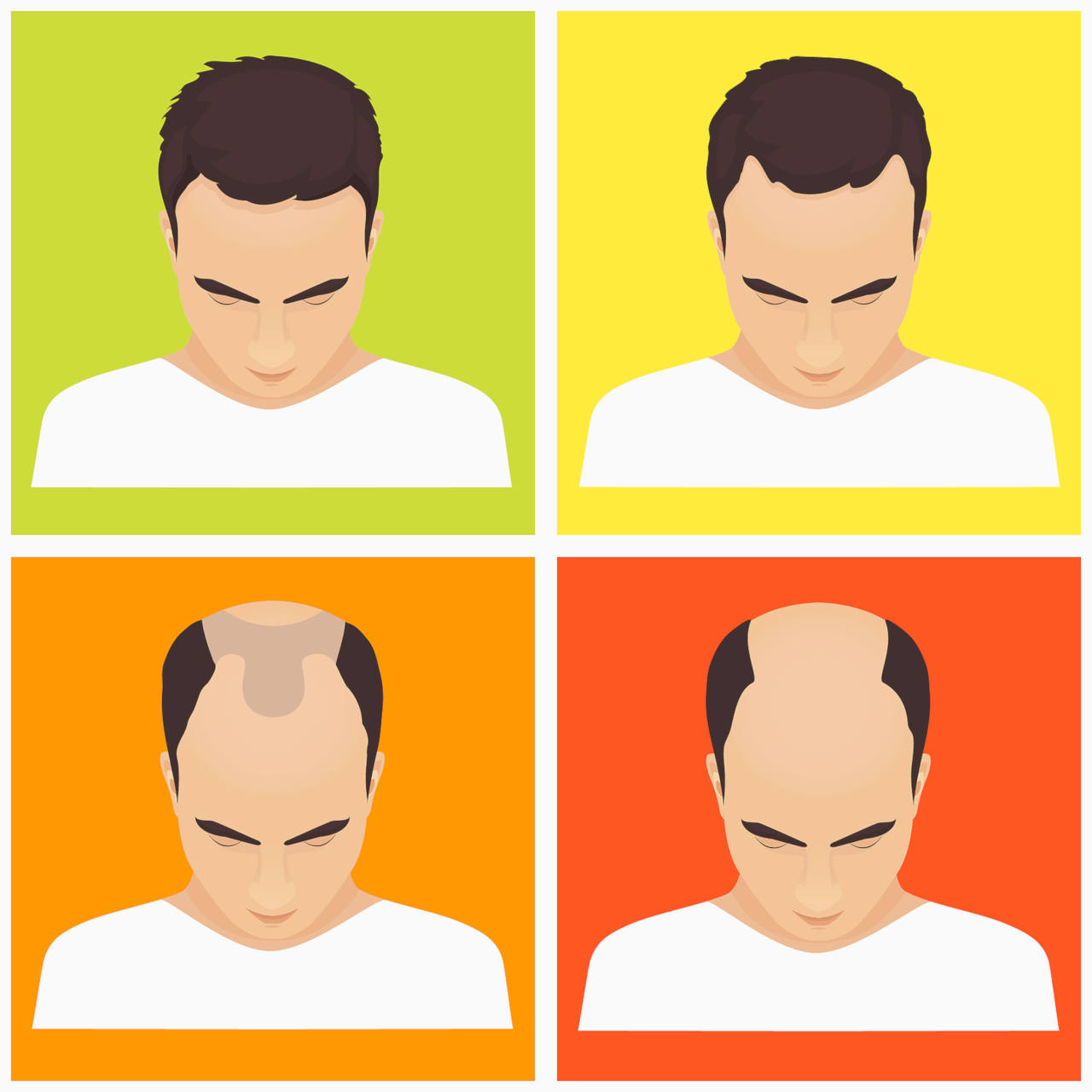 début de calvitie découvrez les symptômes et traitements