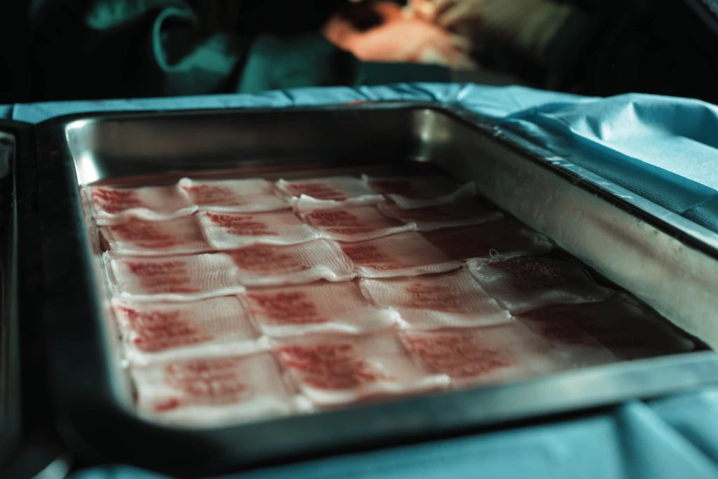 Conservation des greffons au sein de la clinique Elithair