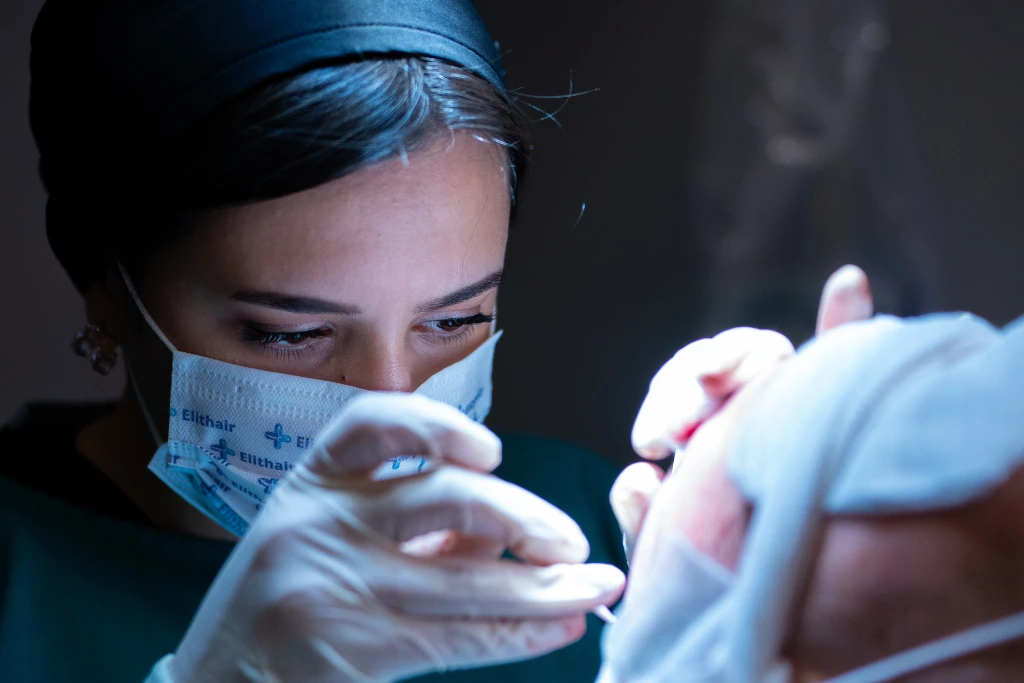 L'équipe médicale Elithair en train d'implanter des greffons capillaires