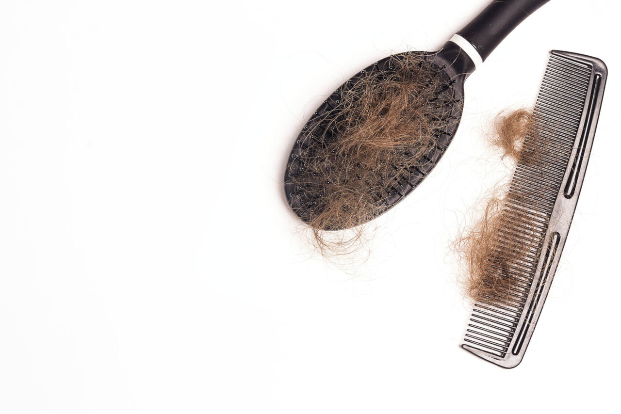 un taux trop important de DHT est generalement la cause de la calvitie