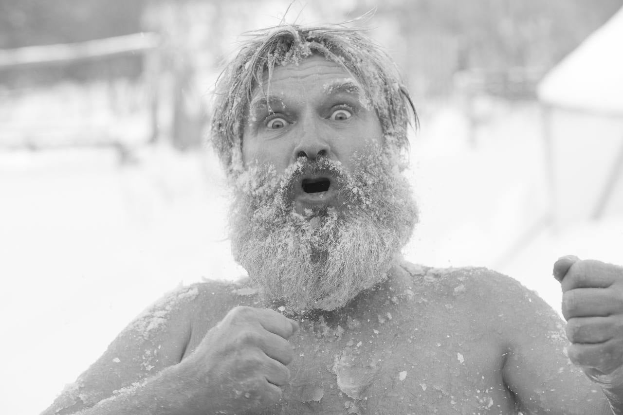 la cryothérapie cheveux peut-elle prévenir la perte de cheveux