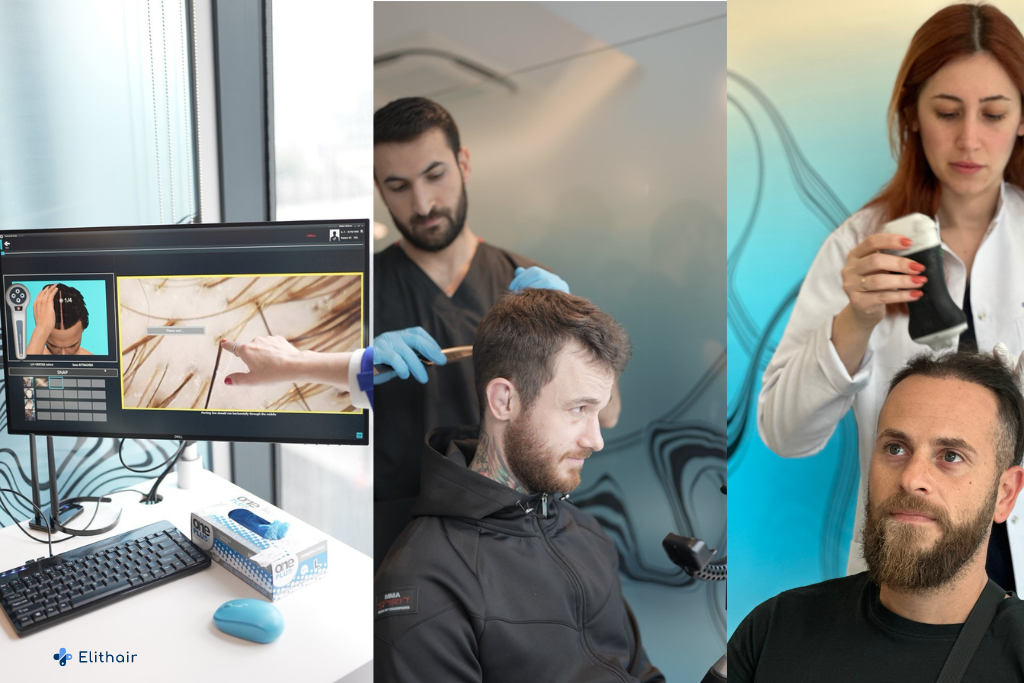 Une prise en charge globale avec Elithair Pre-Test système pour votre greffe de cheveux