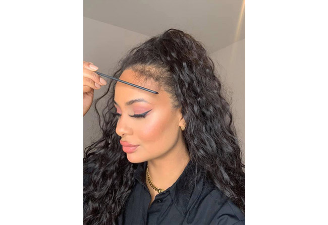 Image après greffe de cheveux femme SDHI 3200 greffons 2 mois Jahy C