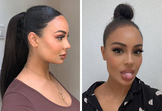 Image resultat de cheveux femme SDHI 3200 greffons Jahy C