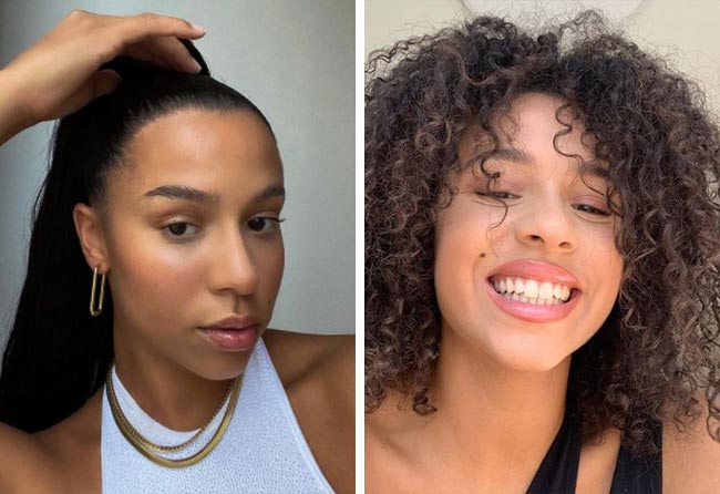 Image après greffe de cheveux femme SDHI 2700 greffons 6 mois Melissa Zerhau