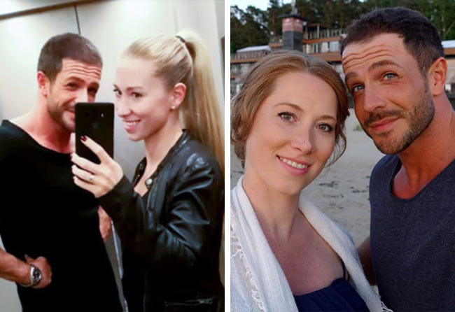 Image apres greffe de cheveux fue saphir 3500 greffons 3 mois Simon Teichmann