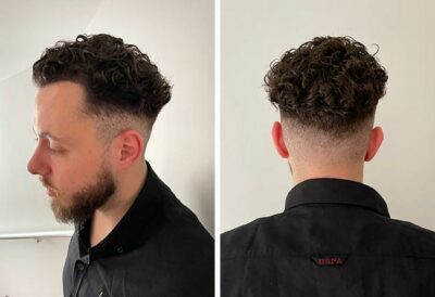 Photo prise 6 mois après la greffe de cheveux dhi avec 3140 greffons du patient Cilian White