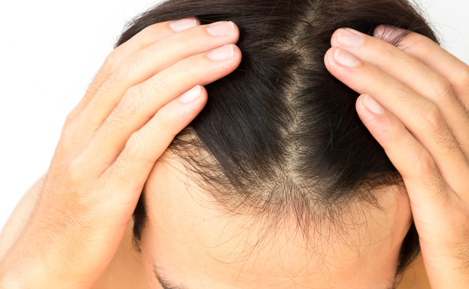 Image d'une femme souffrant d'une perte de cheveux se secoue la tête
