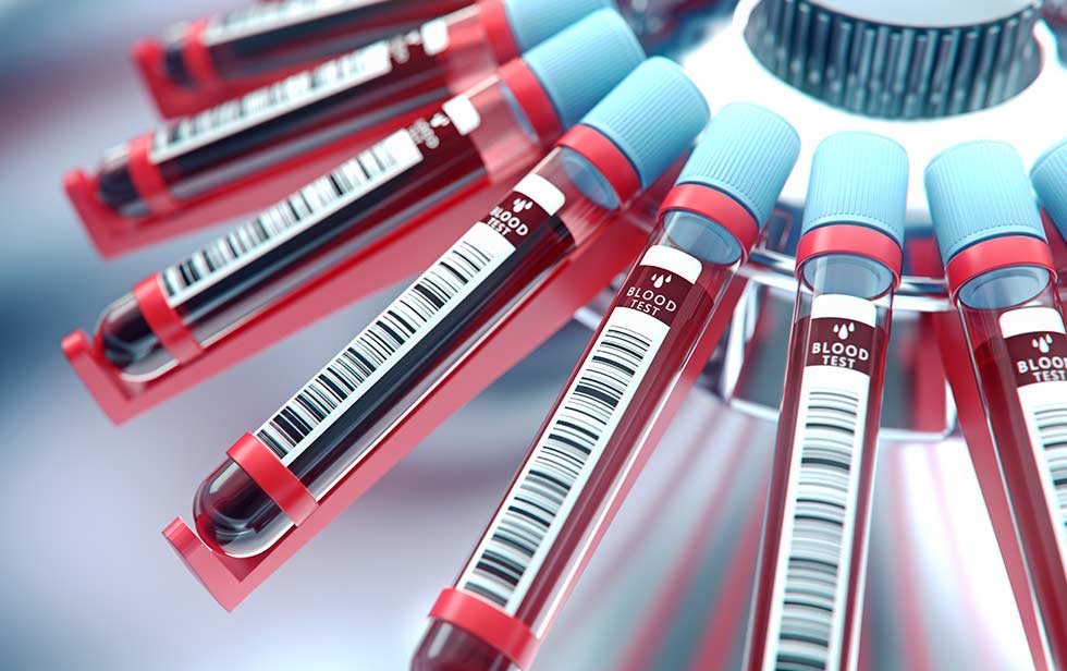 Analyse sanguin capillaire Test en laboratoire Elithair Pre-Test System