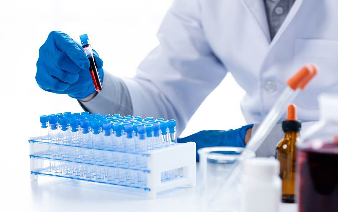 Test en laboratoire Elithair Pre-Test System