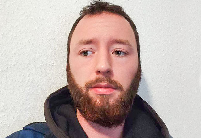 Résultat de Felix V. greffe de barbe Elithair