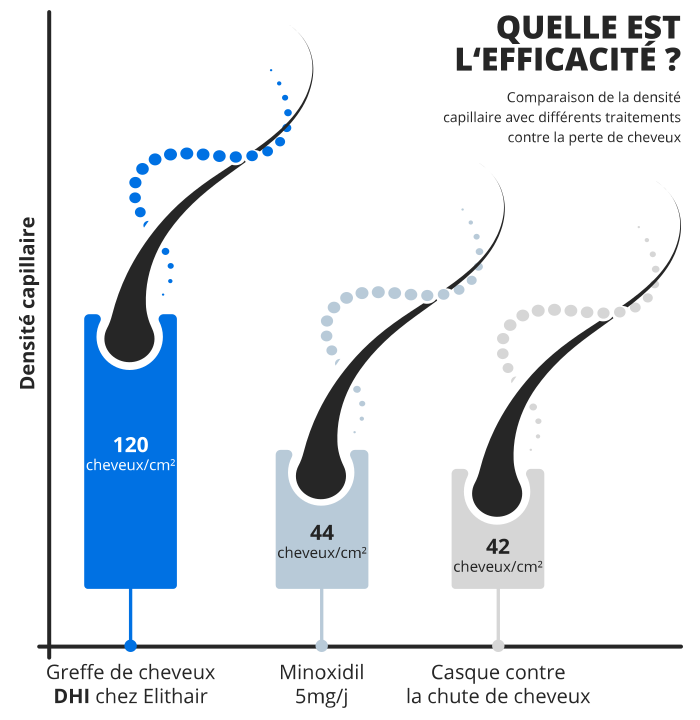Infographie Elithair de la densité capillaire avec différents type de traitement contre la perte de cheveux