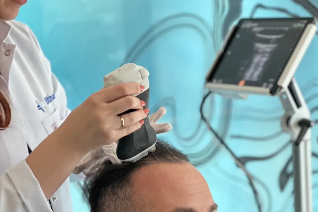 L'échographie Doppler permet d'analyser l'épaisseur du cuir chevelu d'un patient avant son traitement capillaire chez Elithair