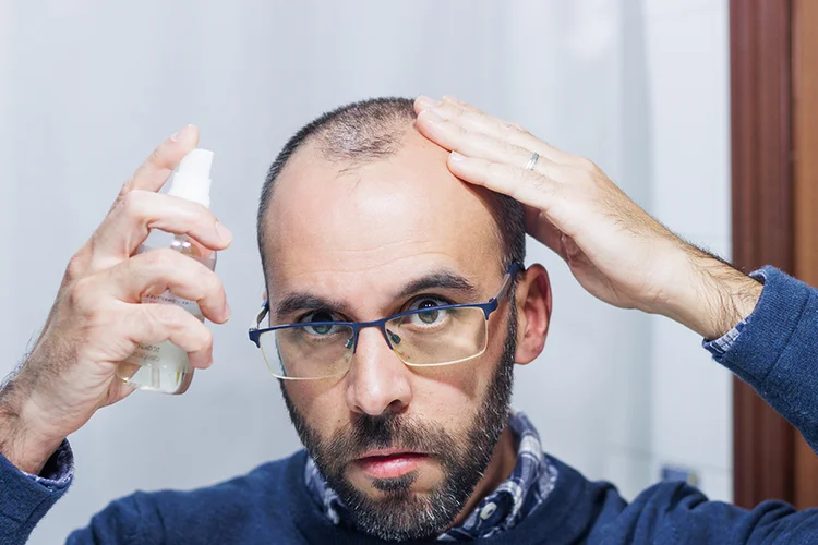 Les hommes se sentent de plus en plus impliqué pour tester de nouvelles alternative de produit sur le marché de la calvitie