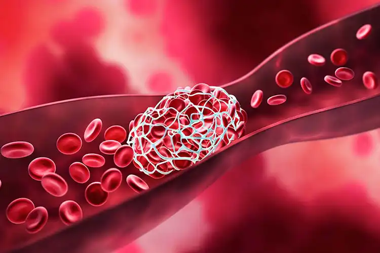 la circulation sanguine est essentielle à prendre en compte dans le repousse capillaire d'une personne souffrant d'une perte capillaire