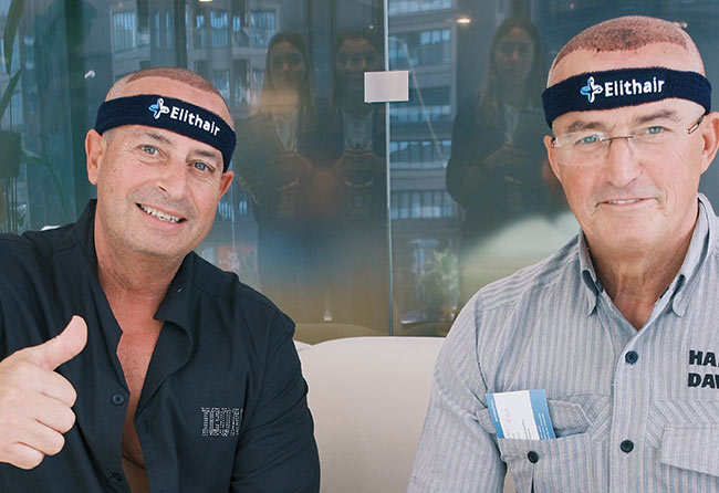 Patients Elithair satisfaits après une greffe de cheveux