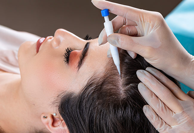 Implantation avec stylo Choi – Patiente technique DHI