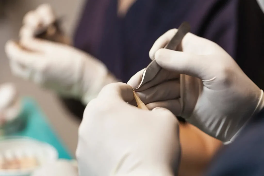 Procédure médicale de greffe de cheveux réalisée en clinique