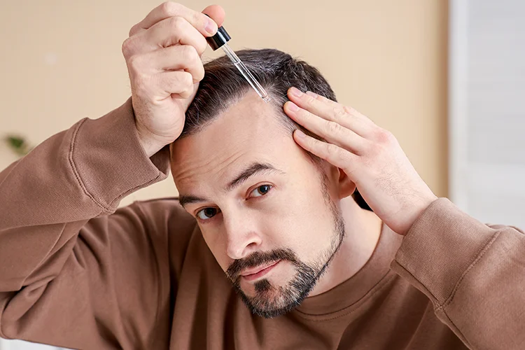 homme montrant l’application d’un sérum directement sur le cuir chevelu pour lutter contre la chute de cheveux et stimuler les follicules pileux.