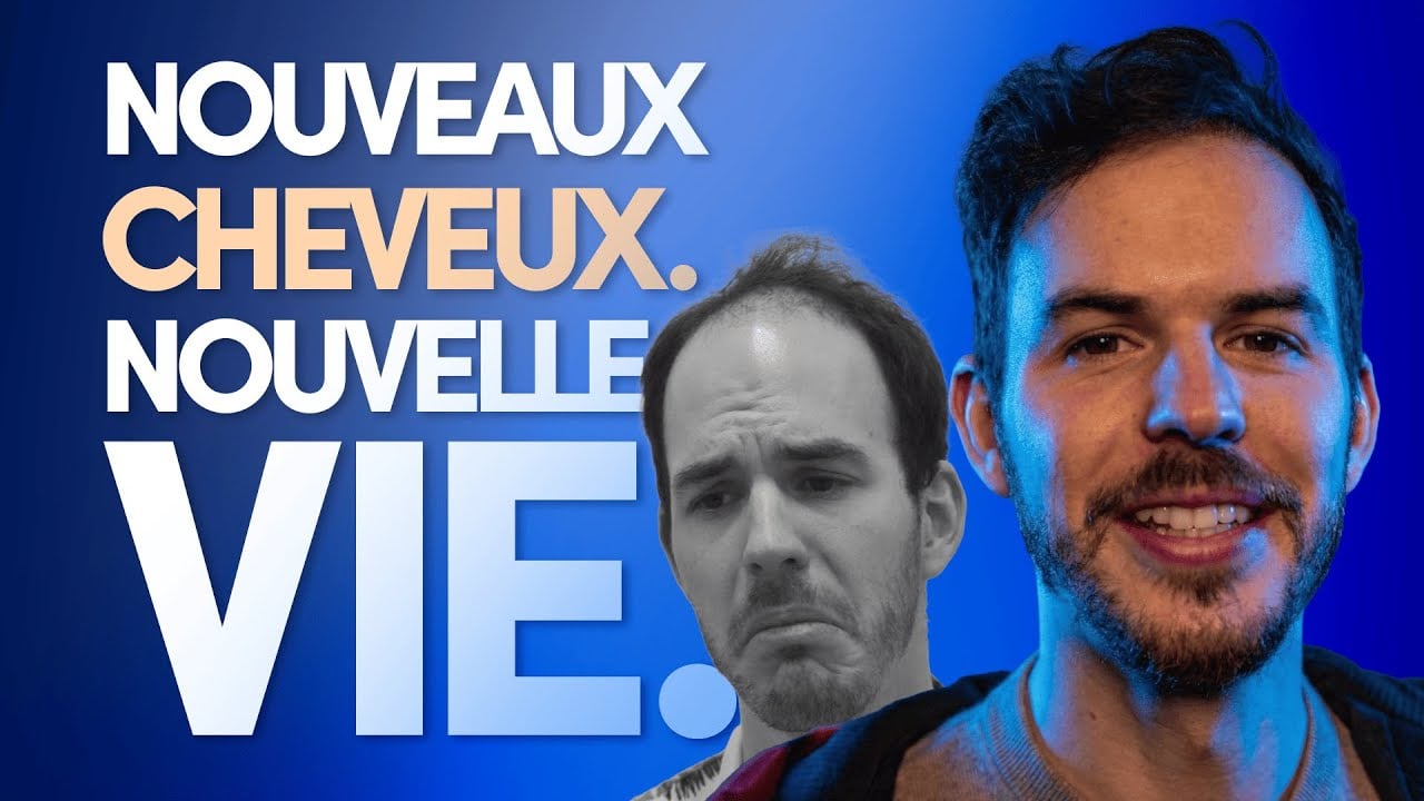 Martin patient chez Elithair qui parle de son expérience et son résultat