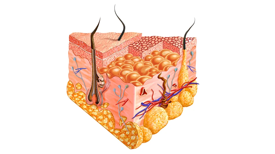 Illustration d’un follicule pileux montrant la circulation sanguine du cuir chevelu et les processus de régénération liés à la greffe de cheveux