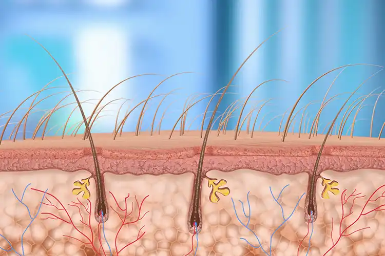 Schéma montrant l’implantation des follicules pileux dans le cuir chevelu.