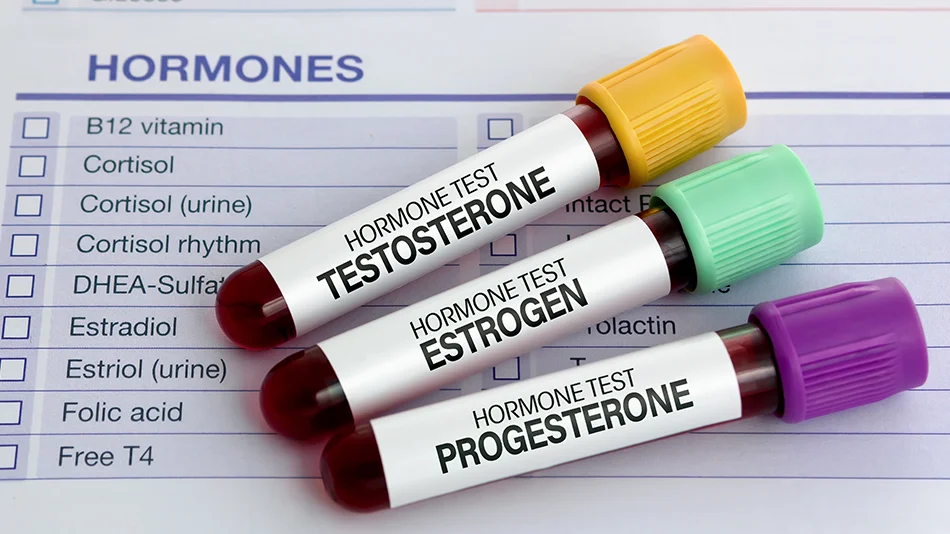 flacons de traitement hormonal avec testostérone et œstrogène utilisés en hormonothérapie