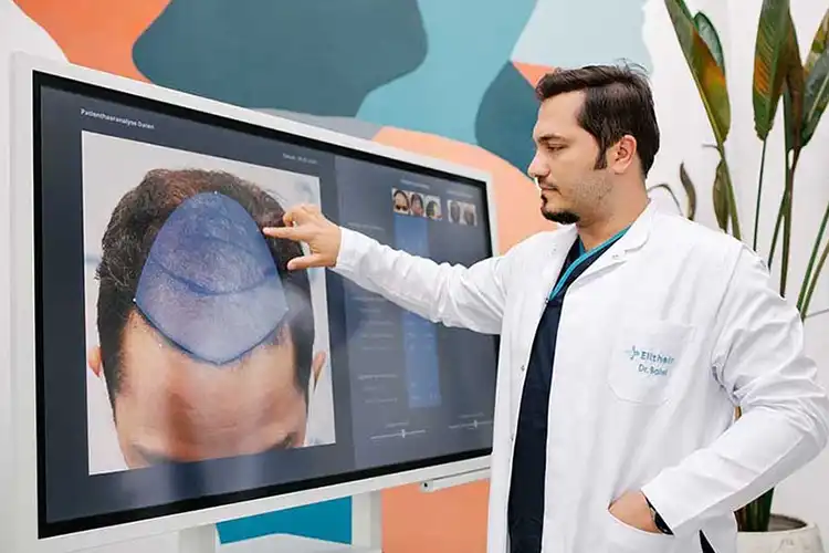 Dr Balwi spécialiste de la greffe de cheveux et fondateur clinique Elithair examinant la densité capillaire d’un patient sur un écran numérique