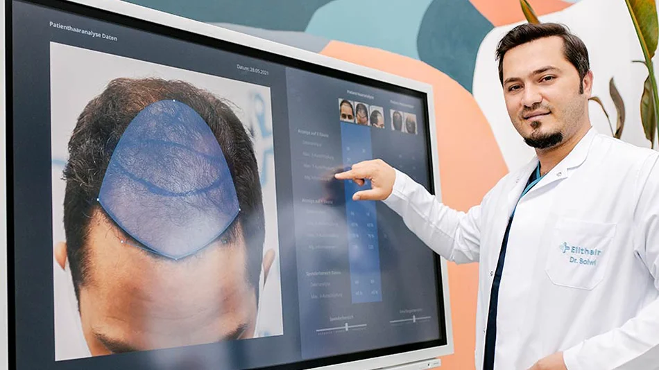 Médecin réalisant une analyse du cuir chevelu avec un scanner avancé pour évaluer la densité et la structure des cheveux